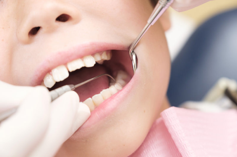 悪い歯並びの原因と歯並びが与える影響